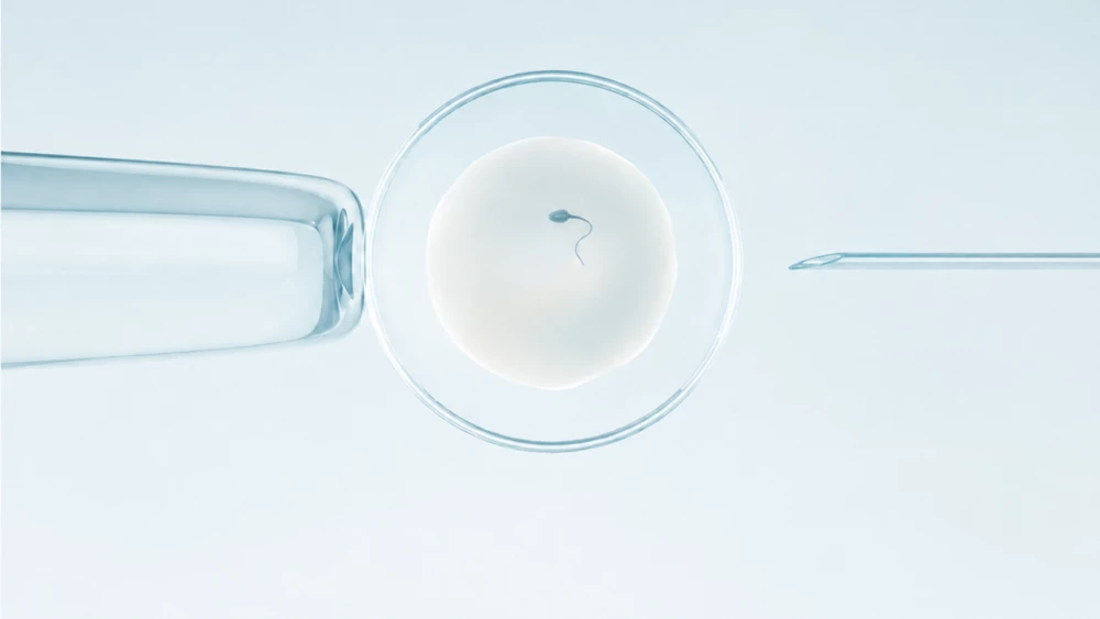 Sophea IVF Injeksi Sperma Intra Sitoplasmik ICSI