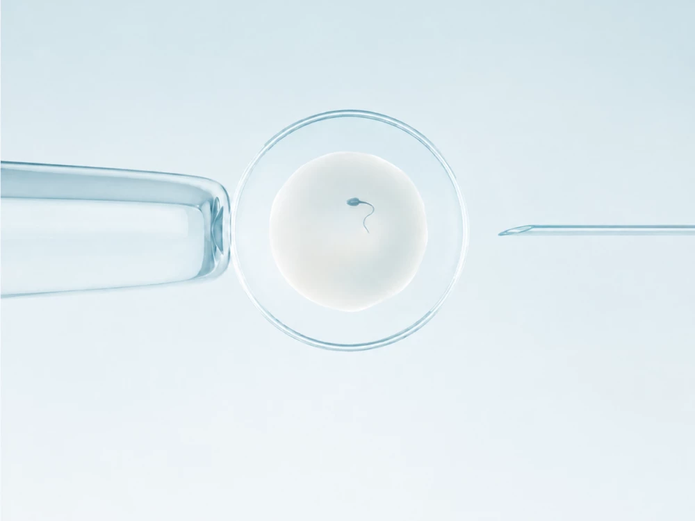 Sophea IVF Injeksi Sperma Intra Sitoplasmik ICSI