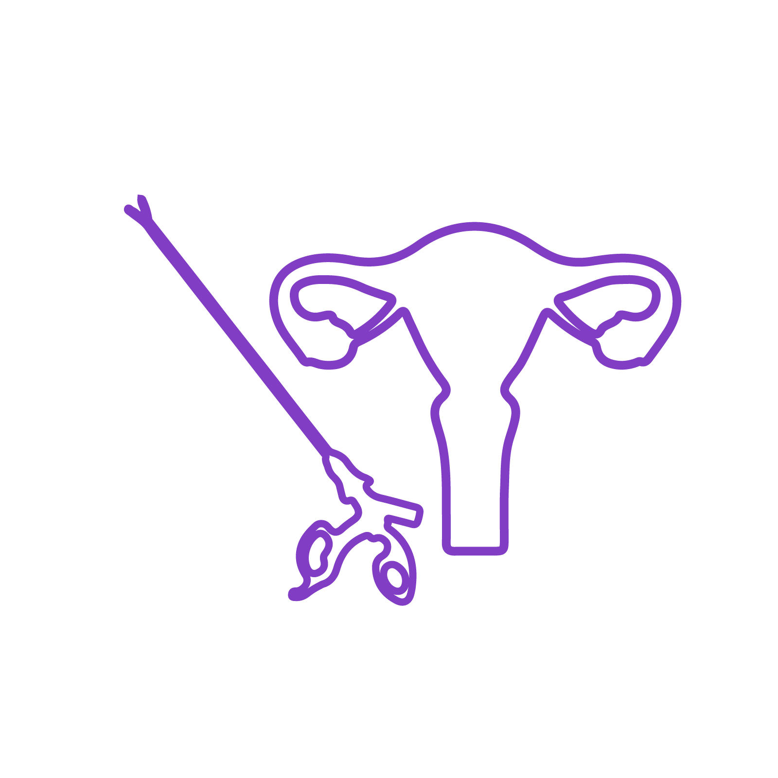 Sophea pembedahan reproduktif untuk menangani masalah kesuburan wanita